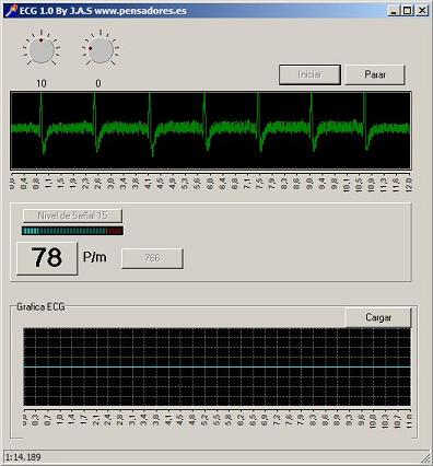 ecg1r